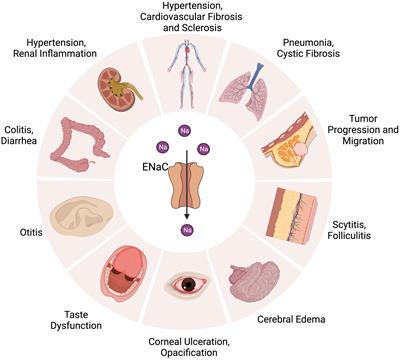 Role of epithelial sodium channel-related inflammation in human diseases